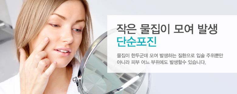 작은 물집이 모여 발생 - 단순포진