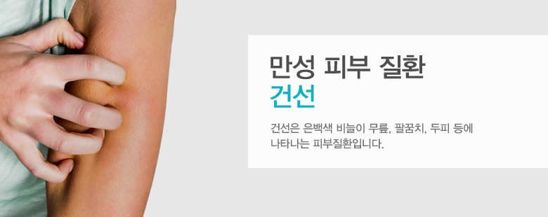 만성 피부 질환 건선