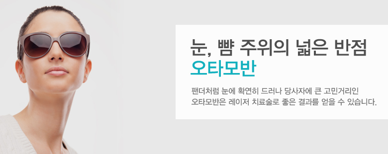 눈, 뺨 주위의 넓은 반점 오타모반
