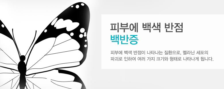 피부에 백색 반전 백반증